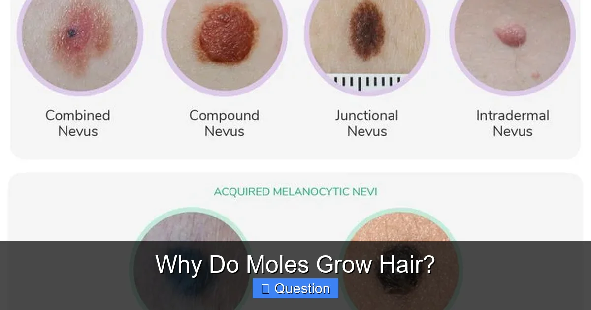 Why Do Moles Grow Hair?